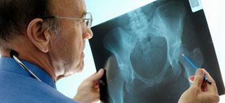 Причины и симптомы остеопороза. Профилактика натуральными препаратами